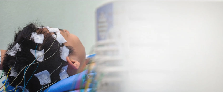 Post-Traumatic-Seizures