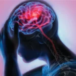 إصابة الدماغ الرضحية