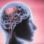 ورم في المخ