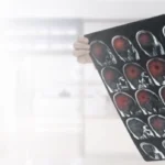 إصابات الرأس الناجمة عن طلقات نارية