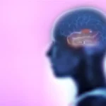 الصرع الفص الصدغي الإضافي