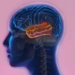 الصرع الصدغي الفصي الأوسط